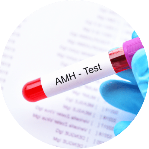 AMH Test